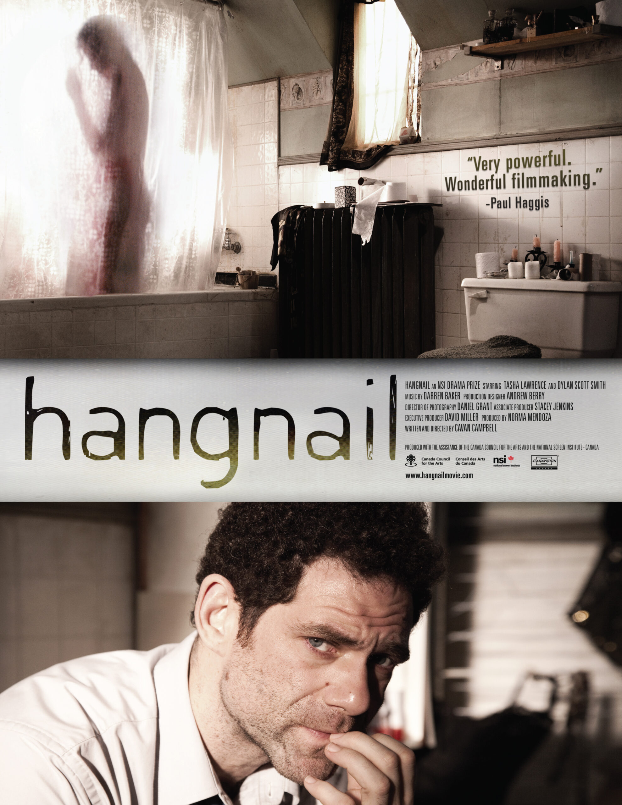 Hangnail